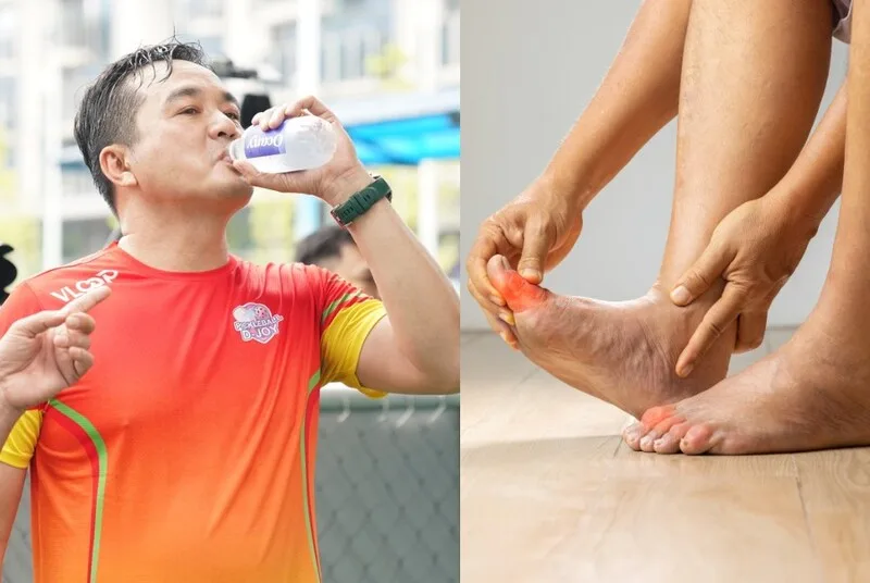 Ngoài ăn uống, lối sống lành mạnh giúp hỗ trợ kiểm soát axit uric và giảm nguy cơ tái phát Gout
